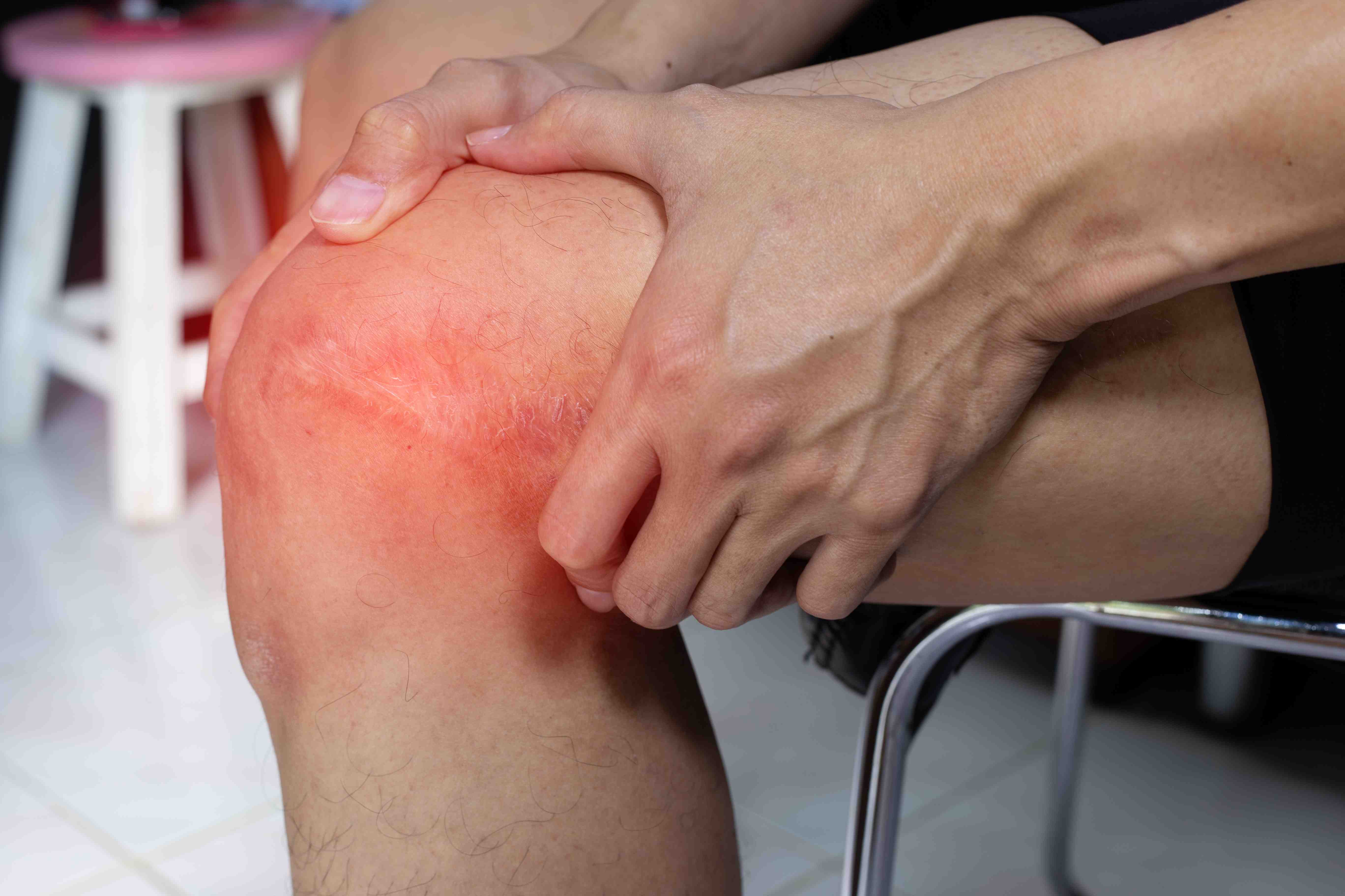 Tratamento para Dor no Joelho: Fisioterapia Especializada em POA